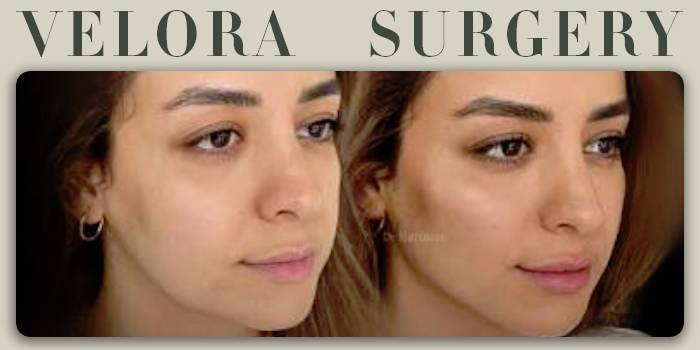 چرا نتایج کانتورینگ در هر فرد متفاوت است؟